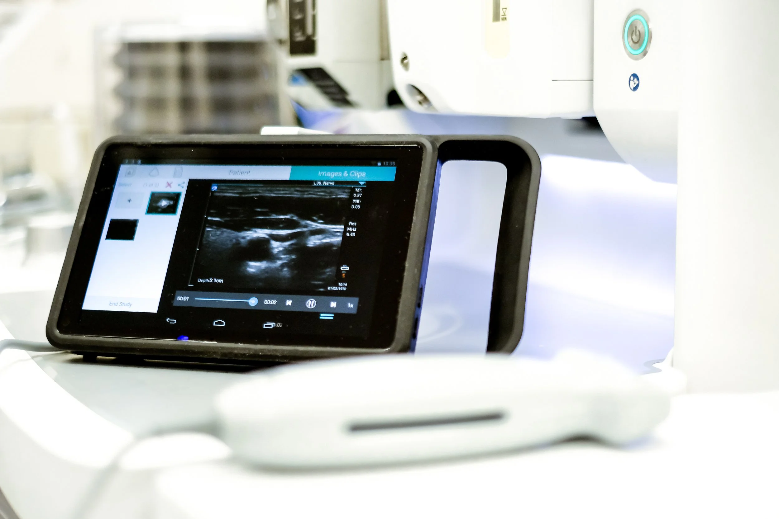 ultrasound.jpg