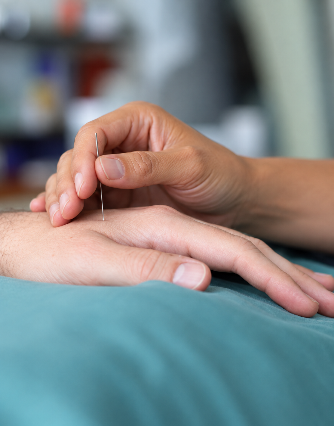 What to expect in an acupuncture session at Bank on Movement, Physiotherapists in Hope