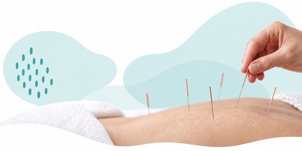 Acupuncture in Hope & Hope Valley