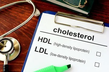 Cholesterol and Lab Monitoring