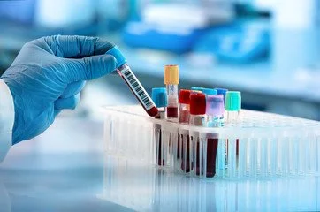 labs.jpg