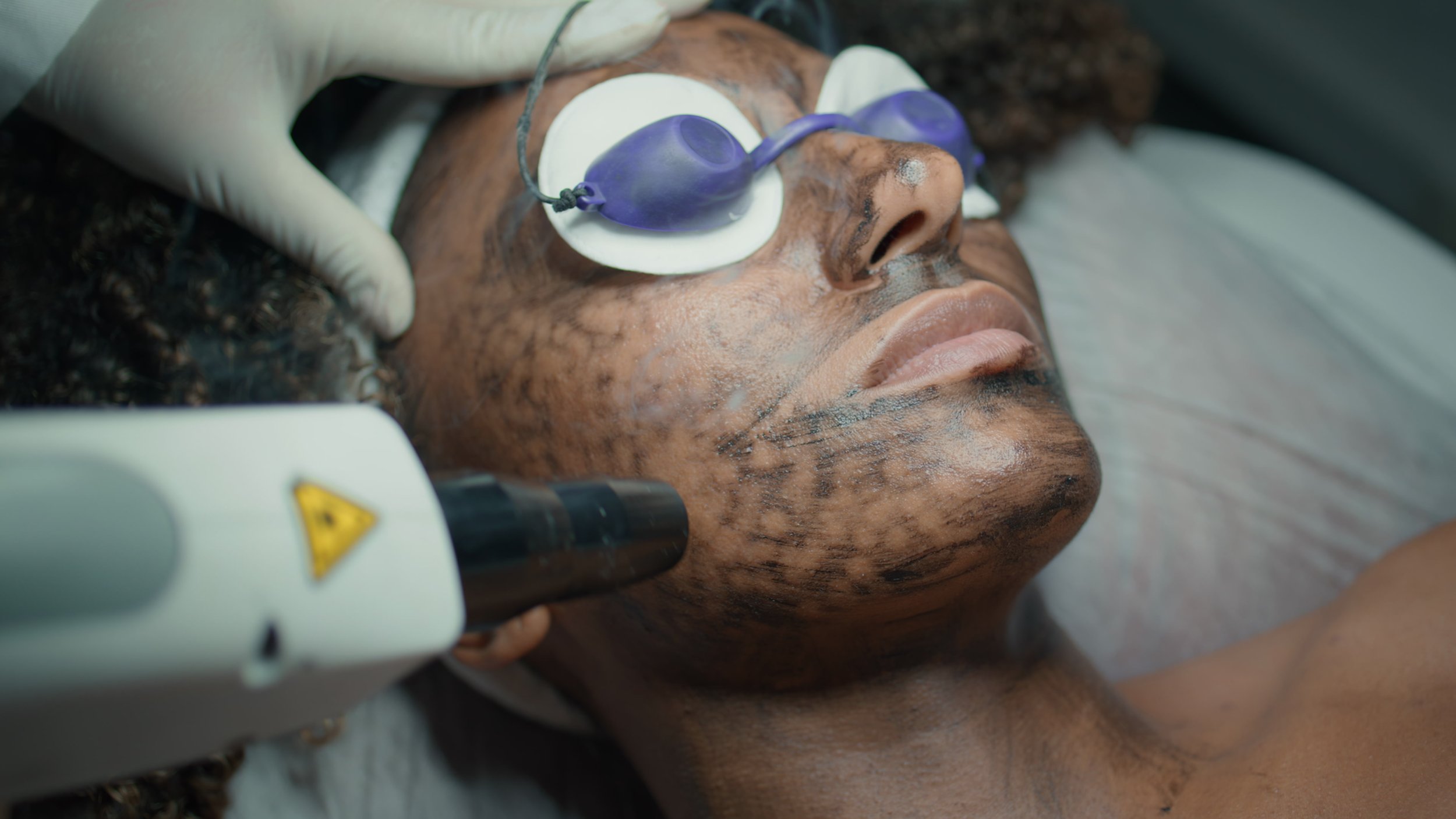 Laser Skin Resurfacing in Clifton Park, NY
