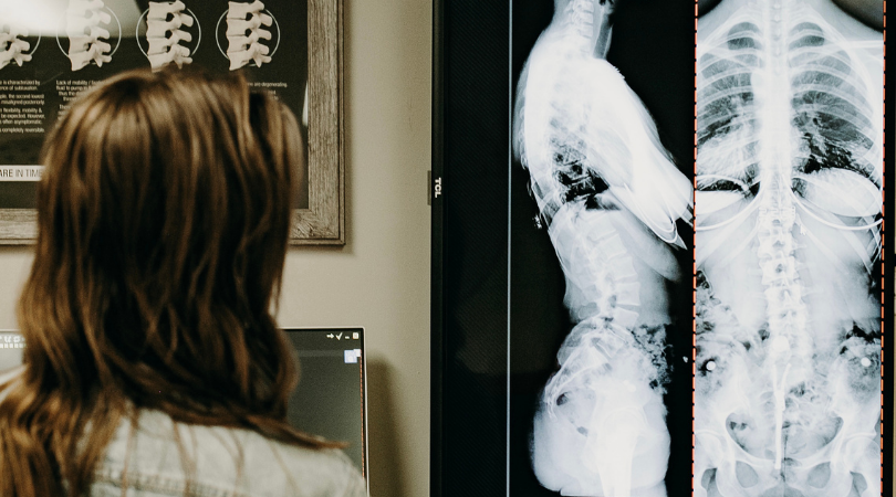 Dr. Jordan Fennelly of Two Sparrows Family Chiropractic in Whitefish, Montana observing and analyzing a chiropractic x-ray using the Gonstead Method.