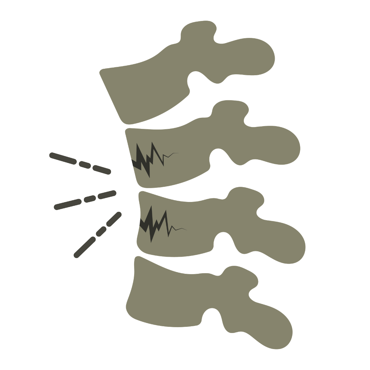 Illustration of a human spine with a focus on the lumbar region, showing vertebrae with cracks and a depiction of pain or injury, indicated by lightning bolt symbols.
