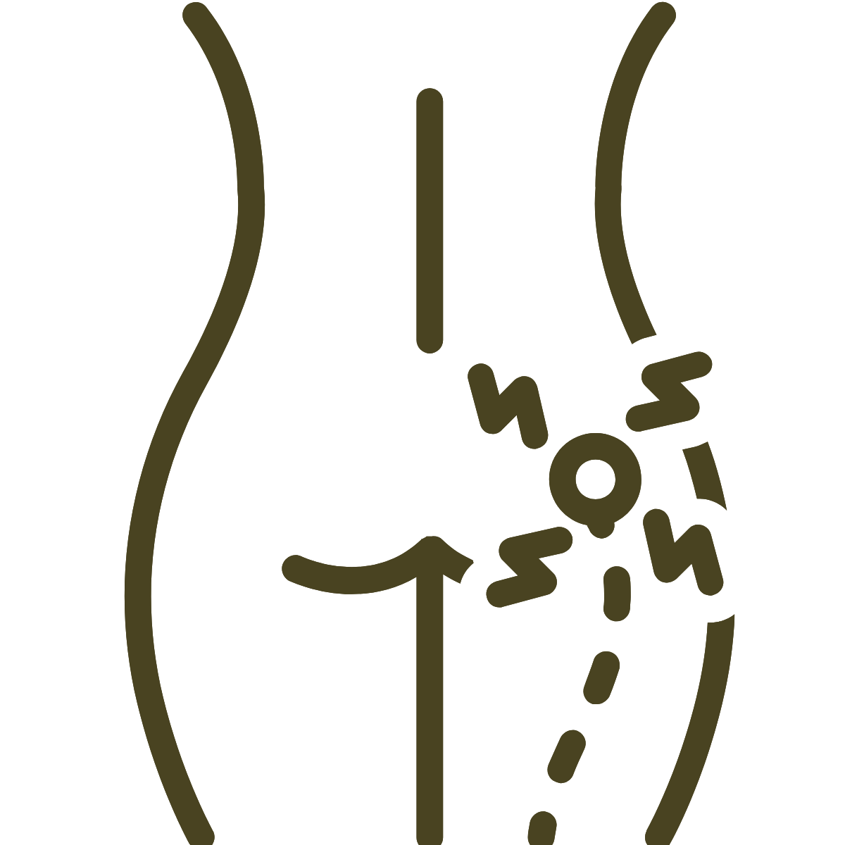 Line drawing of a female breast, indicating ductal pathways and lymph nodes with arrows.