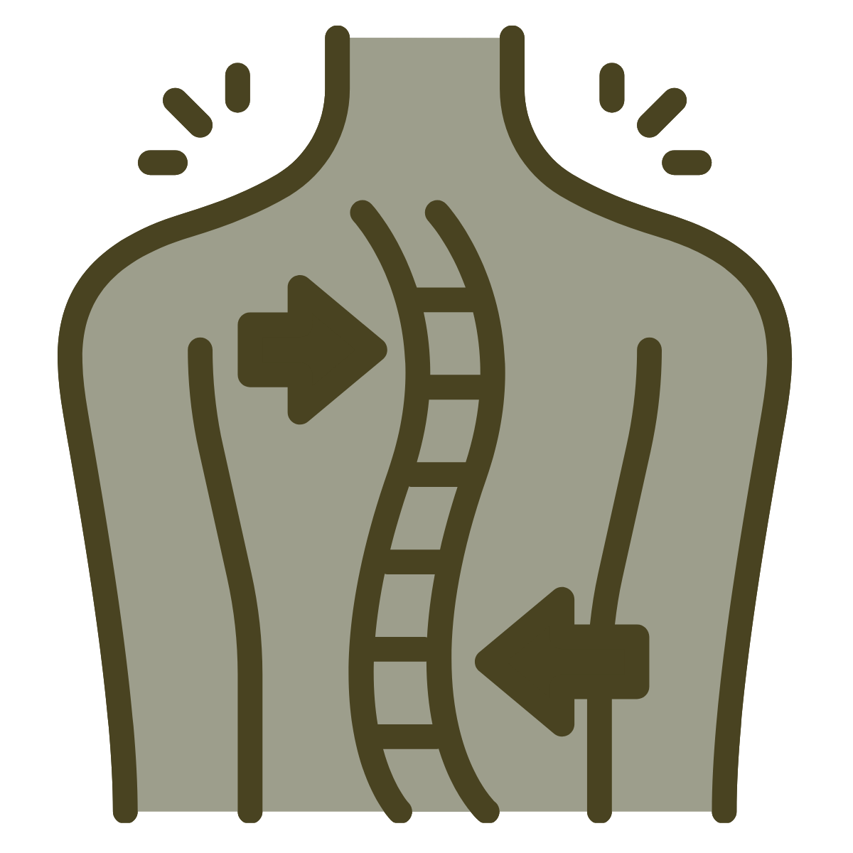 Diagram of a spinal disc herniation with arrows indicating herniated disc pressing against nerve roots.