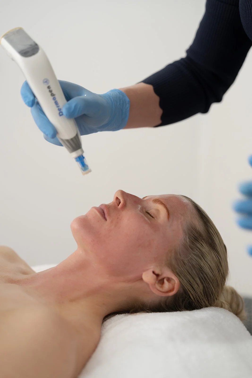 Dermapen 4 Skin Needling: The Gold Standard for Healthier, Stronger Skin