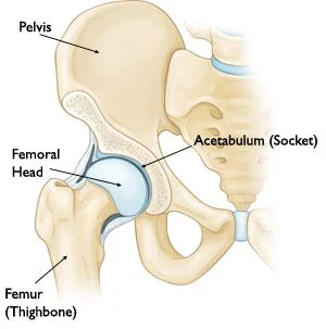 Osteoarthritis – Is Surgery The Only Option?
