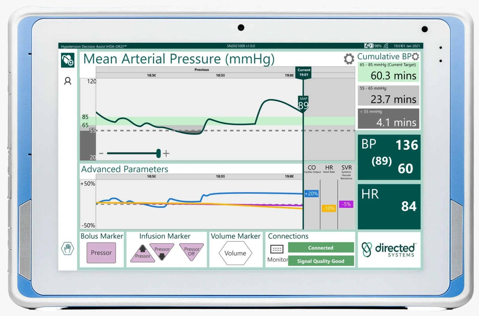 Medical monitor displaying mean arterial pressure, advanced parameters, and system status information.