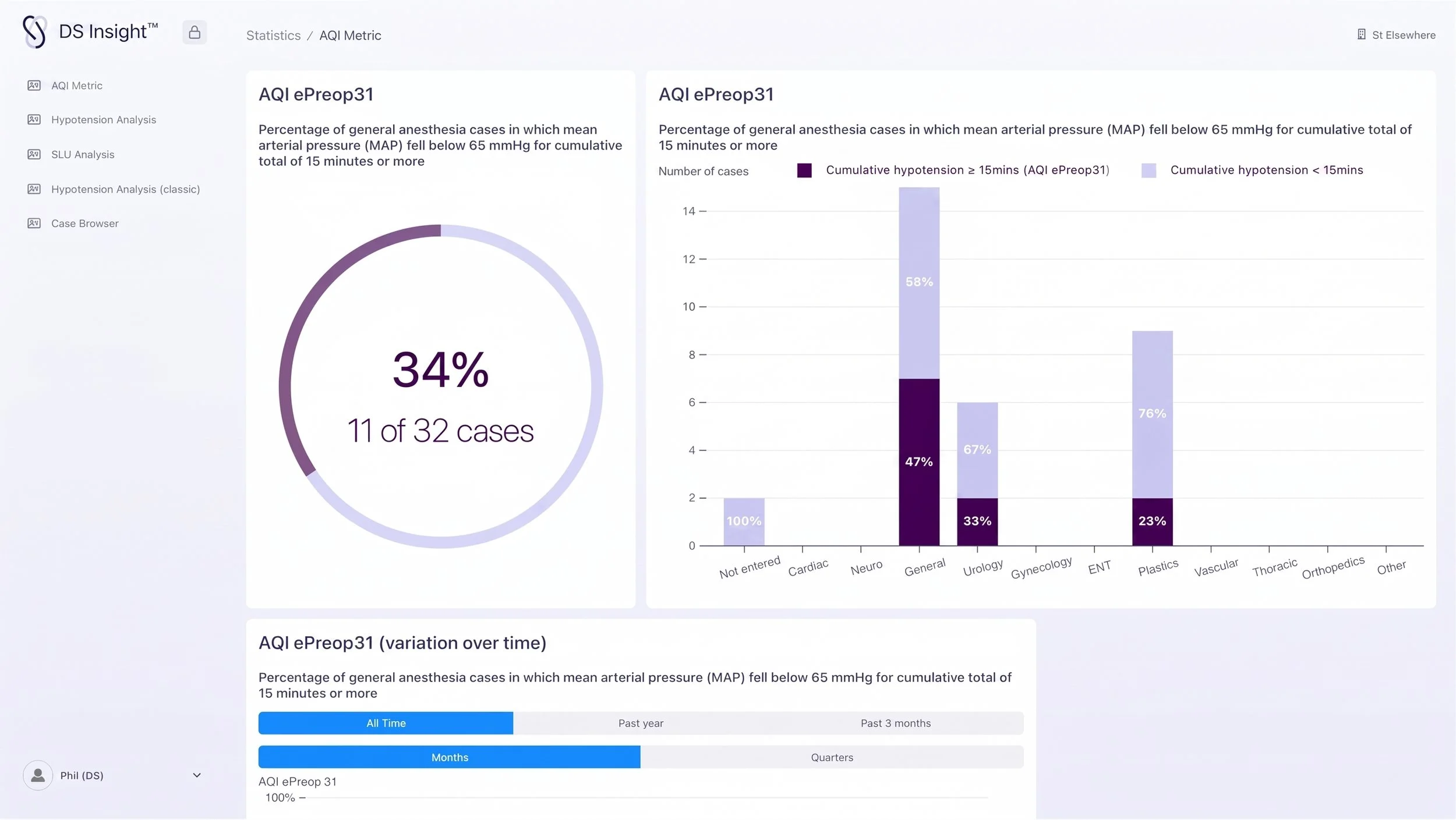 Dashboard displaying AQI ePreop31 statistics including a doughnut chart showing 34% of cases with mean arterial pressure below 65 mmHg for at least 15 minutes, and a bar chart comparing cases with arterial pressure below 65 mmHg for 15 minutes or more across various medical categories such as general, urology, gynecology, ENT, plastics, vascular, thoracic, orthopedic, and others.