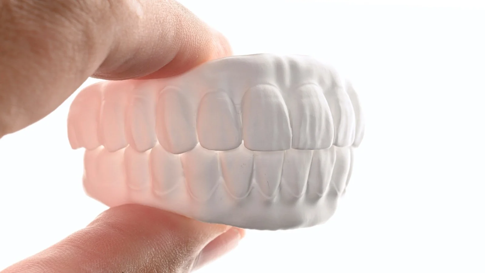 Close-up of a hand holding a dental model showing the upper and lower teeth against a white background.