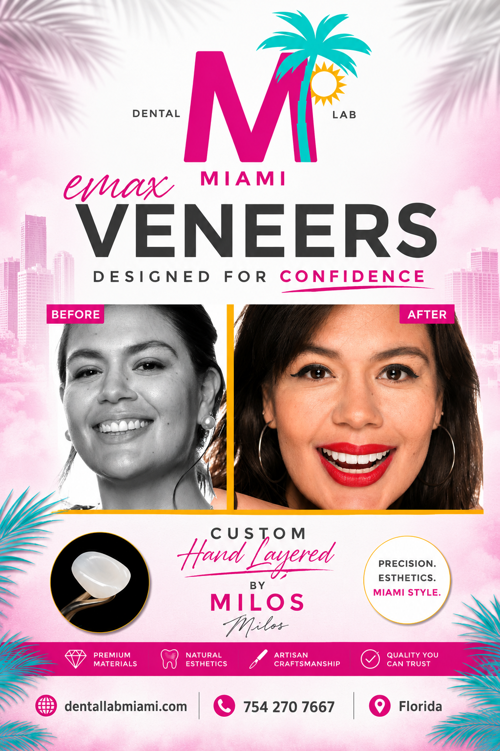 A promotional poster for Miami Dental Lab featuring a before-and-after comparison of a woman's smile, emphasizing confidence with lip veneers. The poster includes colorful graphics, Miami cityscape background, palm trees, and icons highlighting premium materials, natural aesthetics, artisan craftsmanship, and trustworthiness. Contact information and website are also displayed.