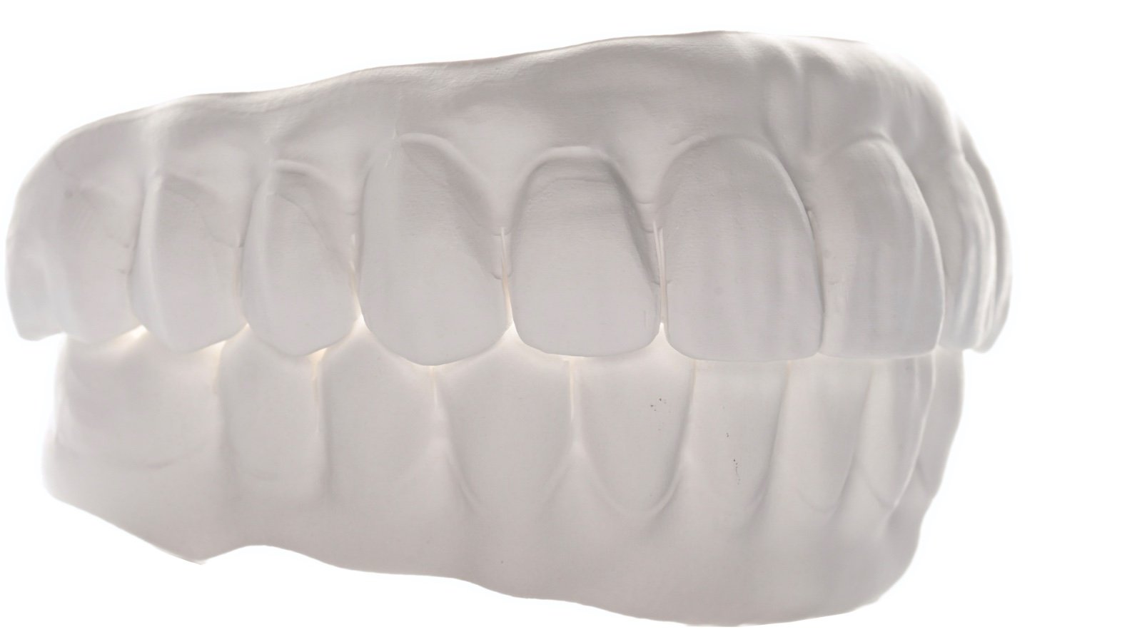 White dental model of upper and lower teeth with gums.