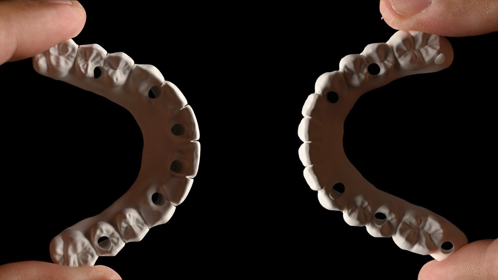 Two dental models of upper teeth held between fingers against a black background.