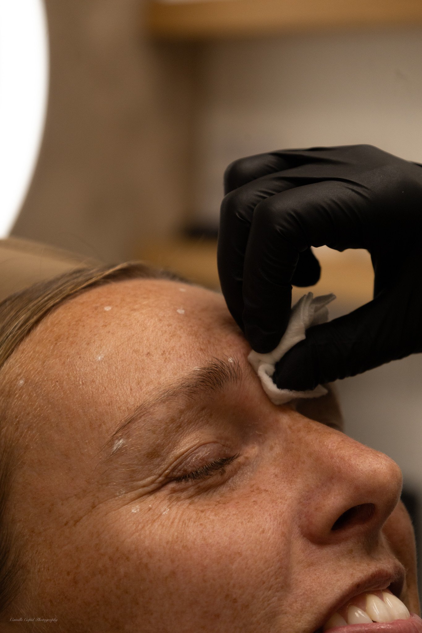 Close-up of a person receiving a facial treatment, with a gloved hand gently touching their forehead near the hairline, and the person's face showing relaxed expressions and skin details.
