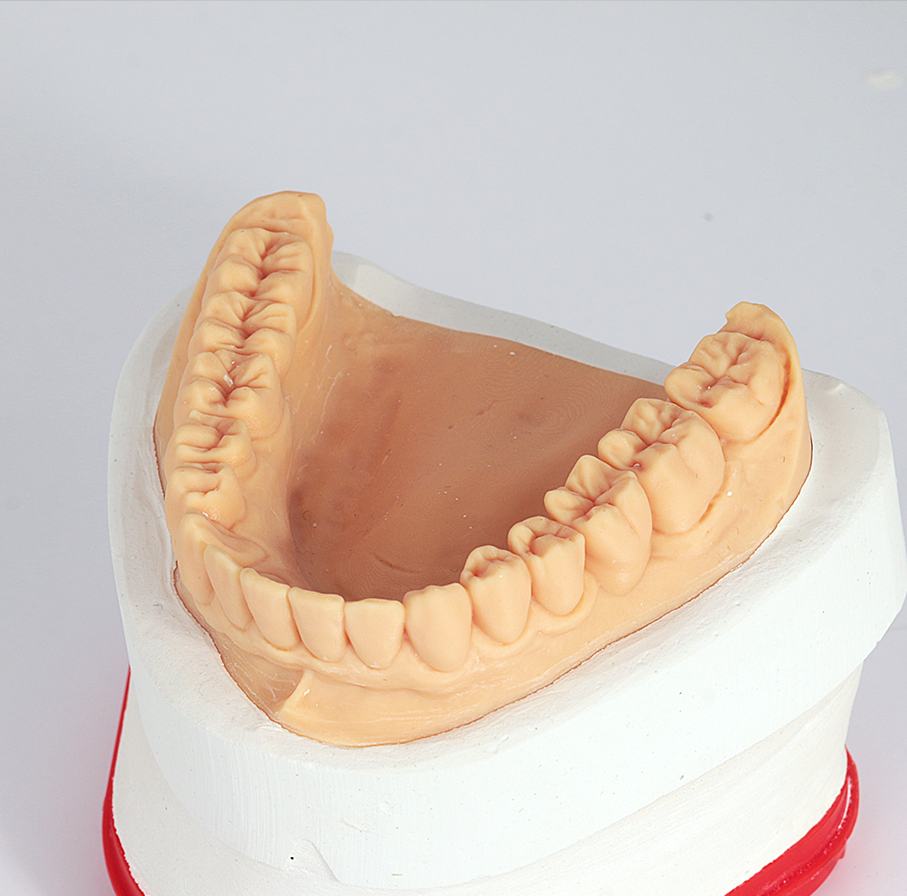 A dental plaster model of the upper jaw with beige-colored artificial teeth.
