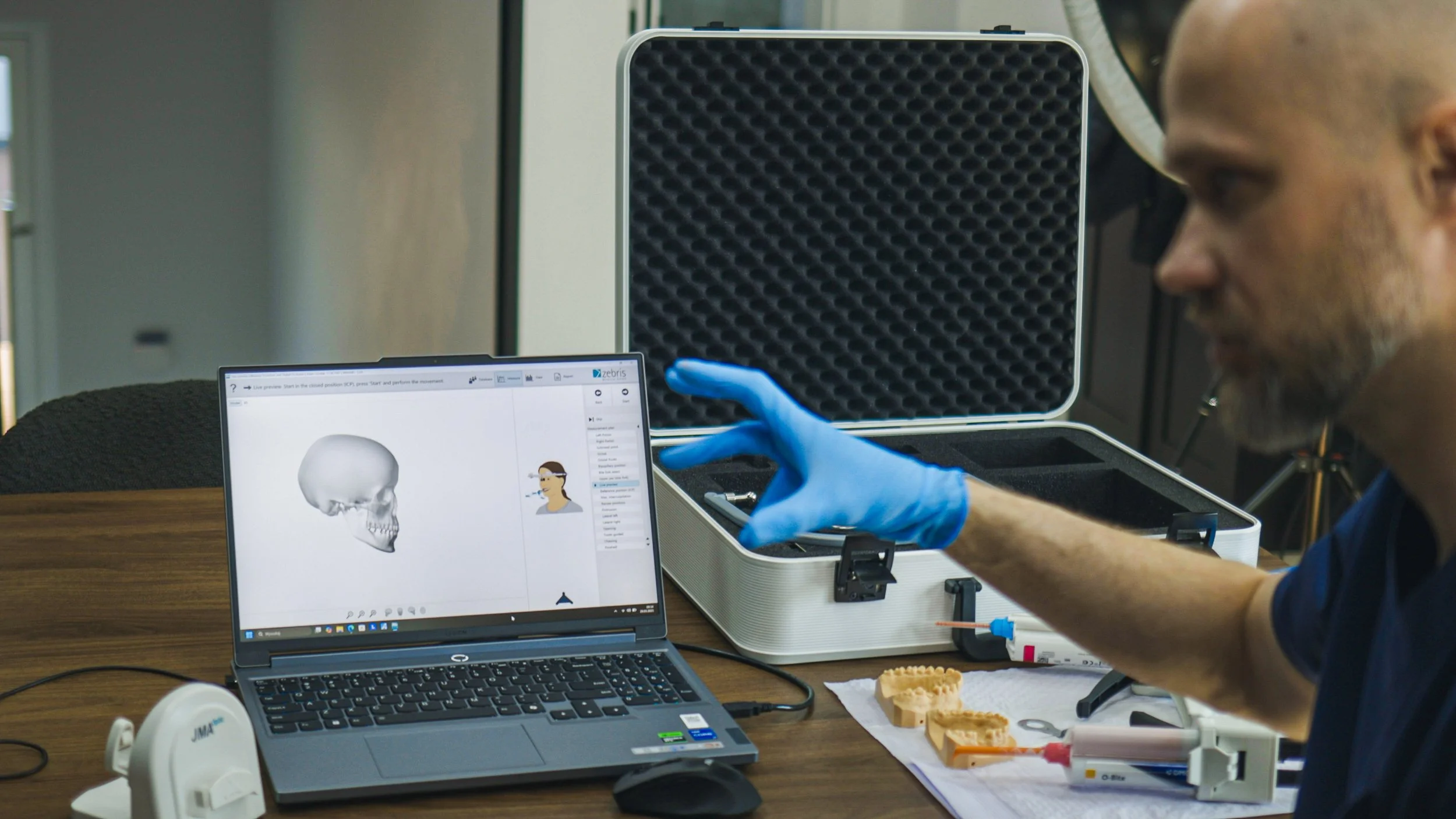 A person wearing a blue glove is pointing at a suitcase containing medical or scientific equipment. There is a laptop displaying a 3D skull diagram and a person profile, with a box containing various tools next to it.
