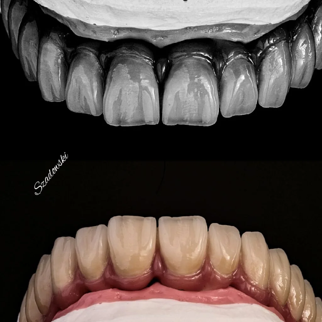 Close-up of two dental models showing teeth, one in black and white and the other in color, with the word "Szkodowski" written on the side.