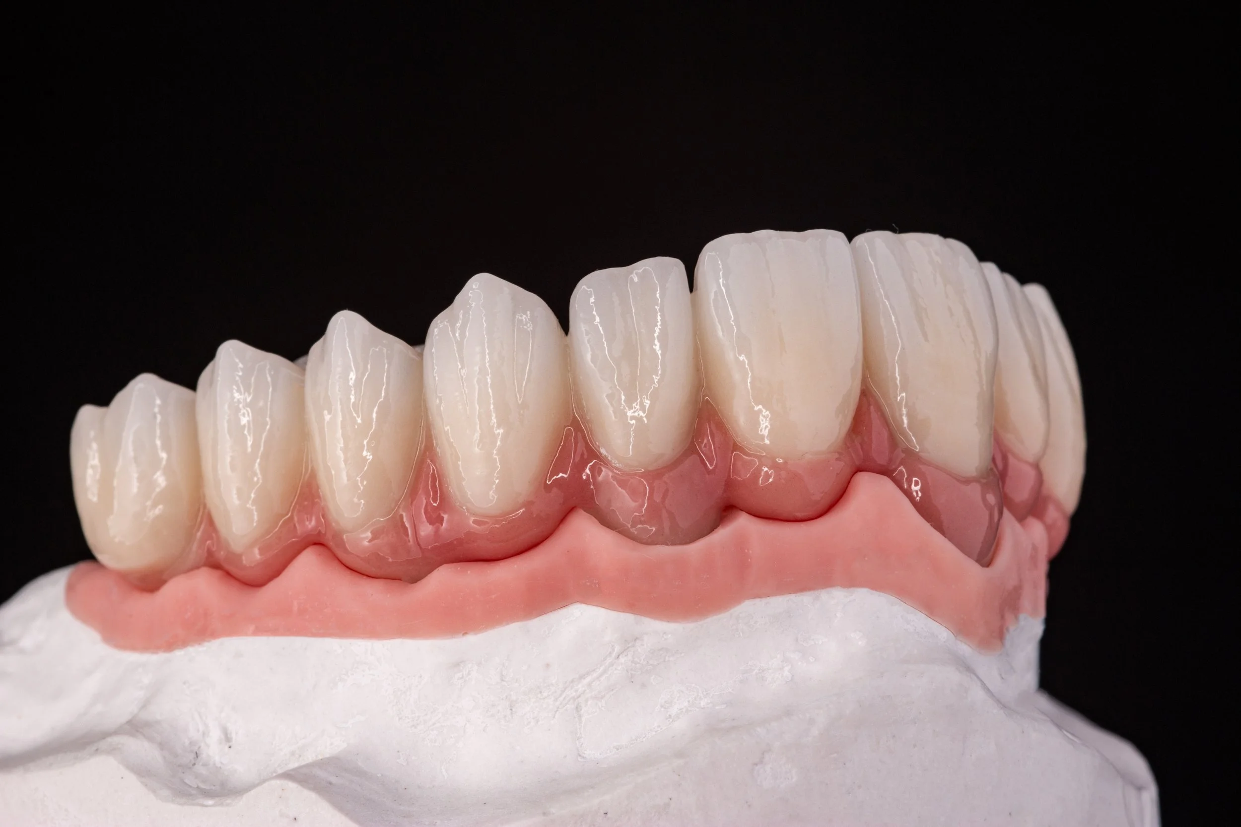 A detailed model of a human set of upper teeth with gums, displayed against a black background.