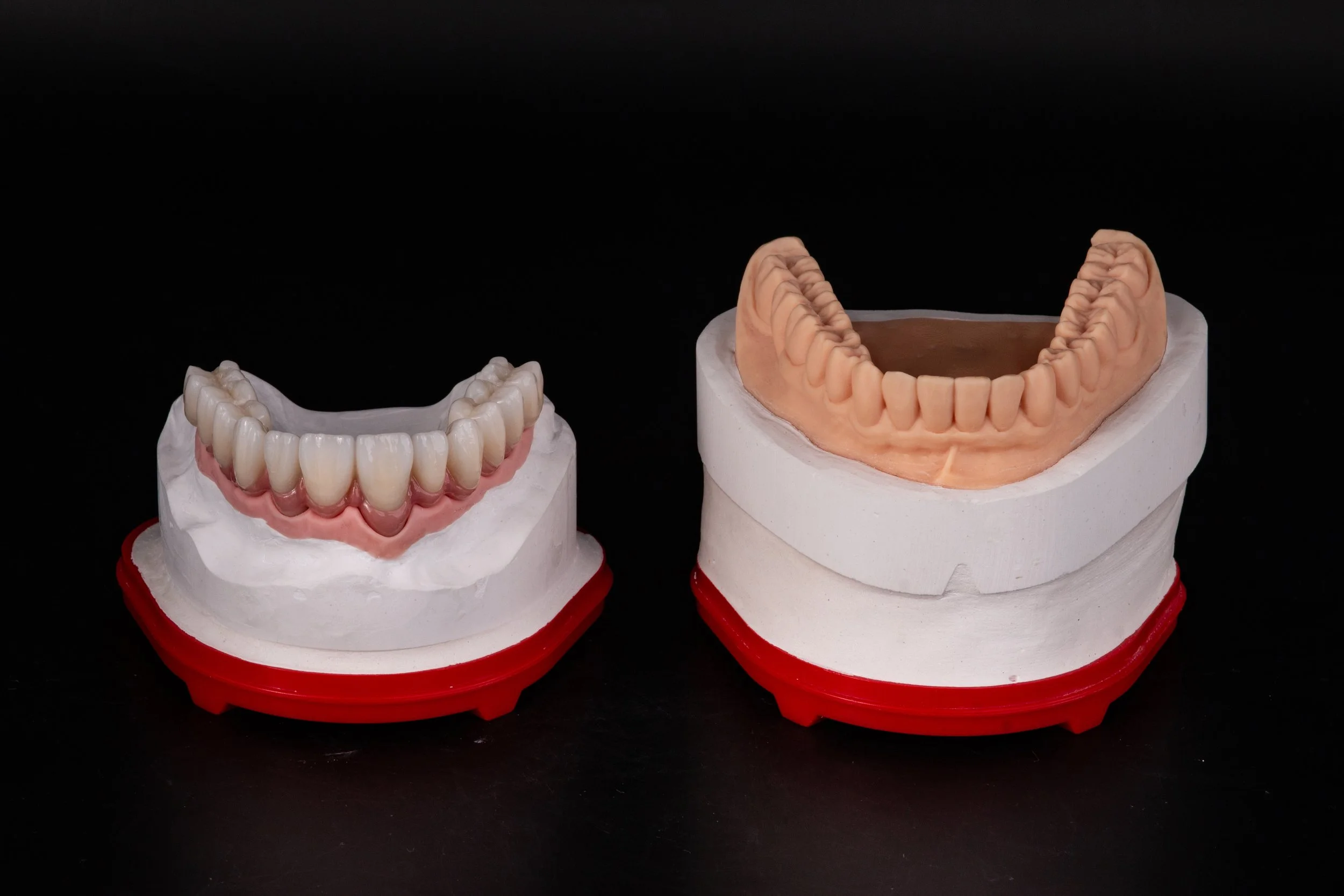 Two dental models showcasing different types of dentures. The one on the left features a full upper denture with a pink base, and the one on the right displays a full lower denture with a tan-colored base.