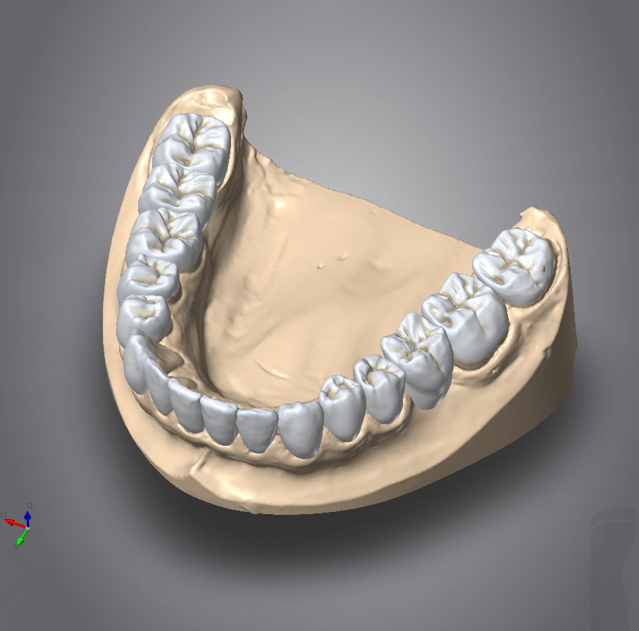 3D digital model of a lower jaw with teeth, showing the dental arch and individual molars, premolars, canines, and incisors.