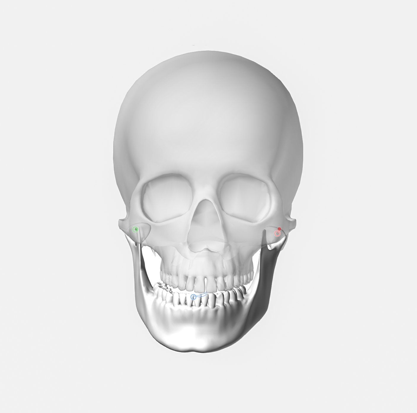 A 3D model of a human skull viewed from the front, showing eye sockets, nasal cavity, and teeth. There are small colored markers near the cheekbones.