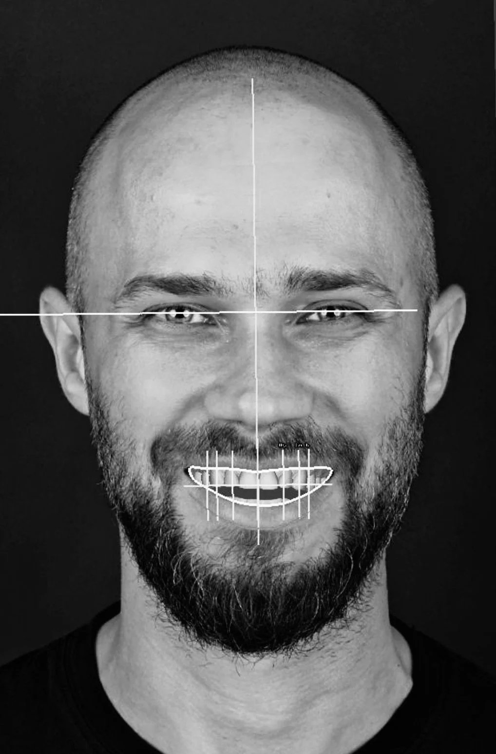 Black and white portrait photograph of a smiling man with a beard, with facial alignment lines overlaid on his forehead, eyes, nose, and mouth. The background is black.