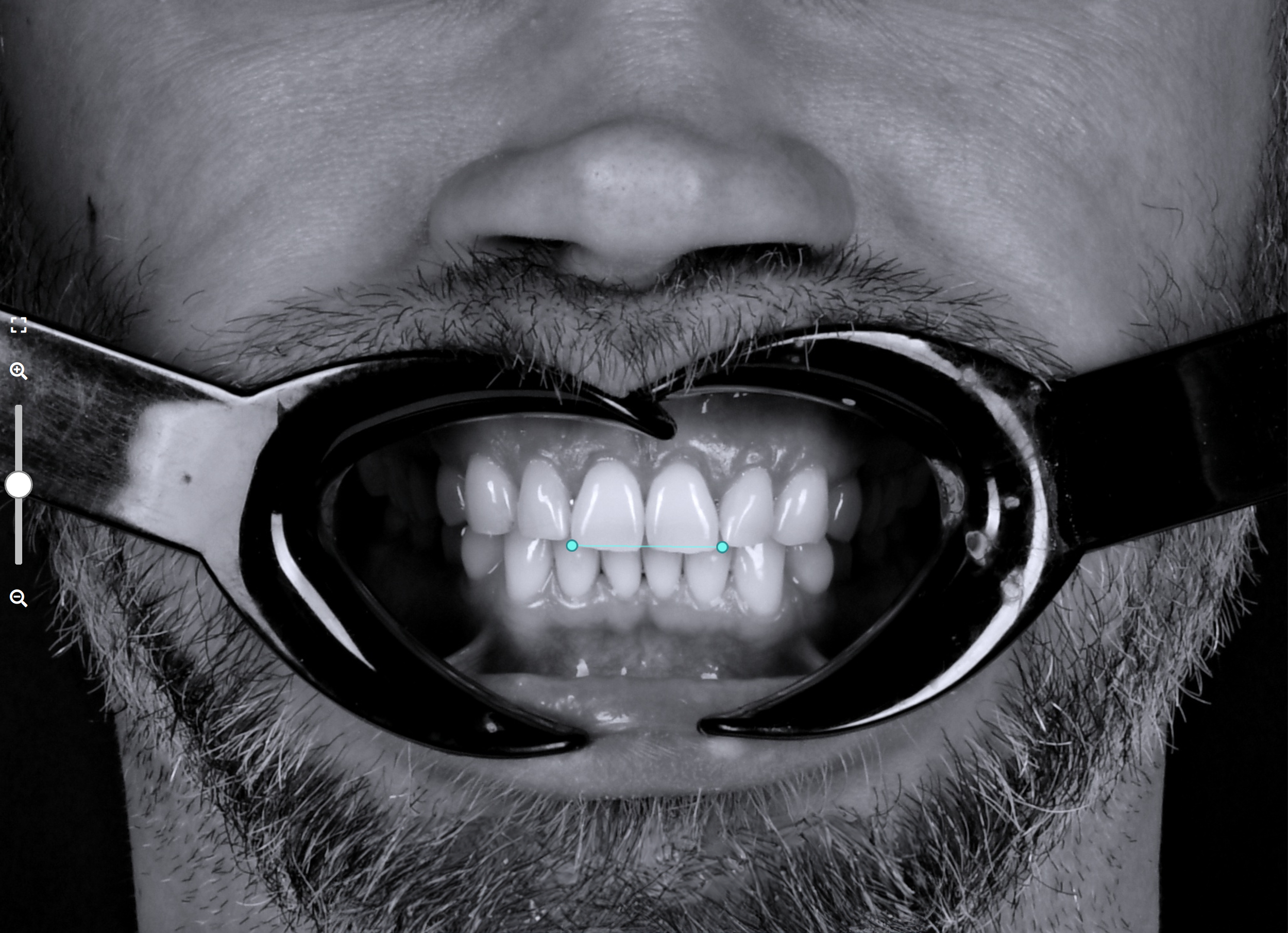 Close-up of a person's face, showing lips, nose, and facial hair, with sunglasses reflecting light.