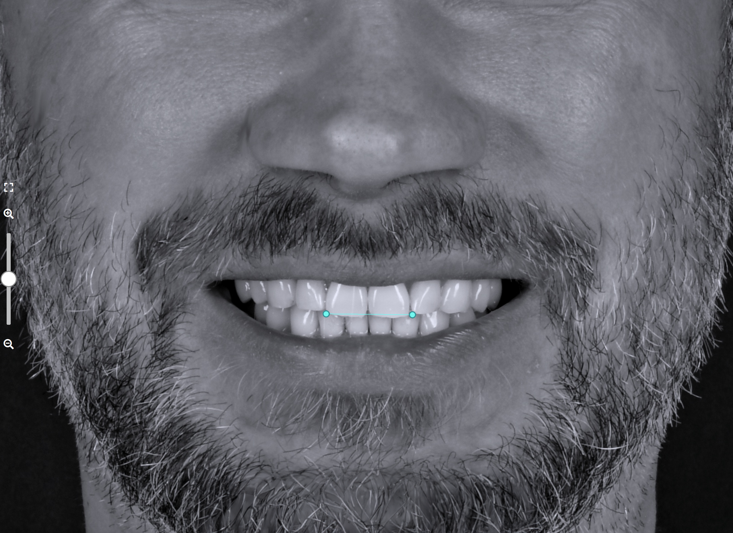 Close-up of a man's mouth and nose, showing beard and facial hair, in black and white.