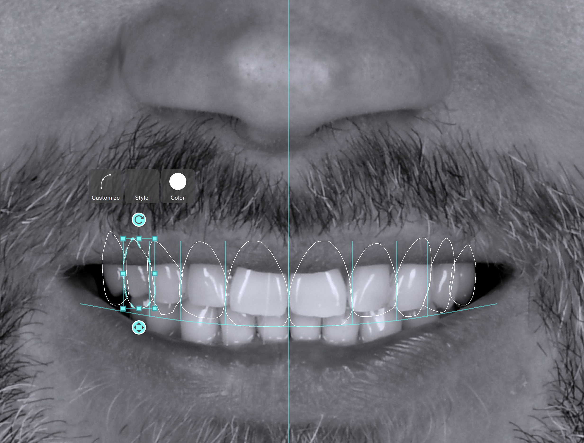 Close-up of a human nose and mouth, with lips slightly parted, showing teeth, and a partial view of facial hair and facial features.