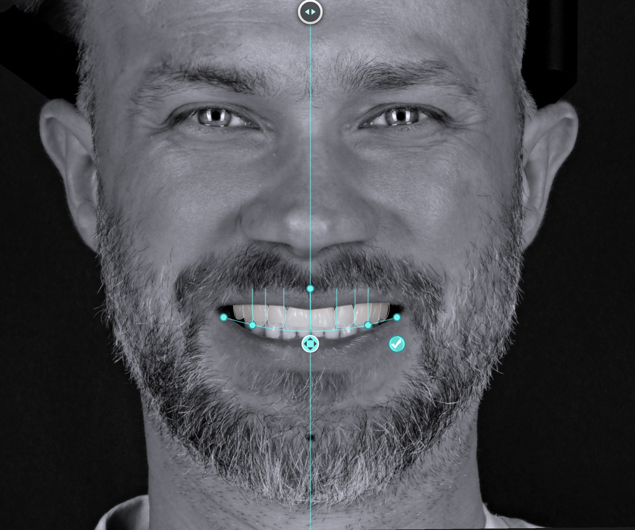 Close-up of a man's face with a beard, smiling slightly, with digital markings indicating facial features.