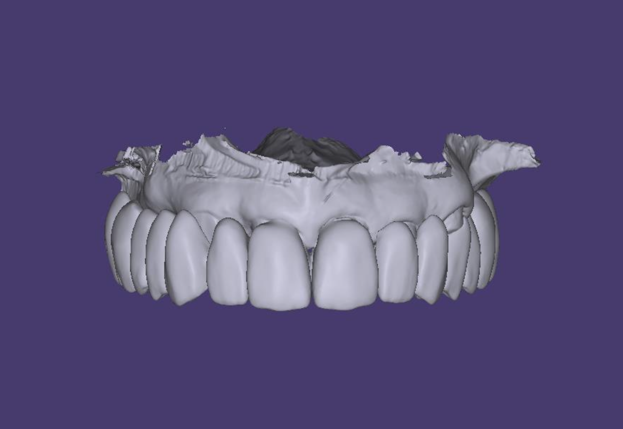 Digital 3D rendering of a set of human upper teeth and gums.