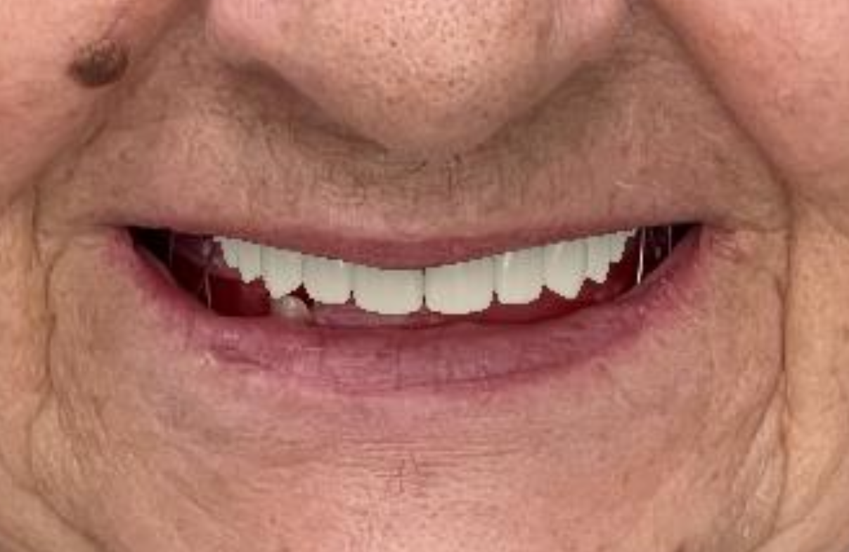 Close-up of a smiling elderly person's mouth showing teeth and wrinkles.