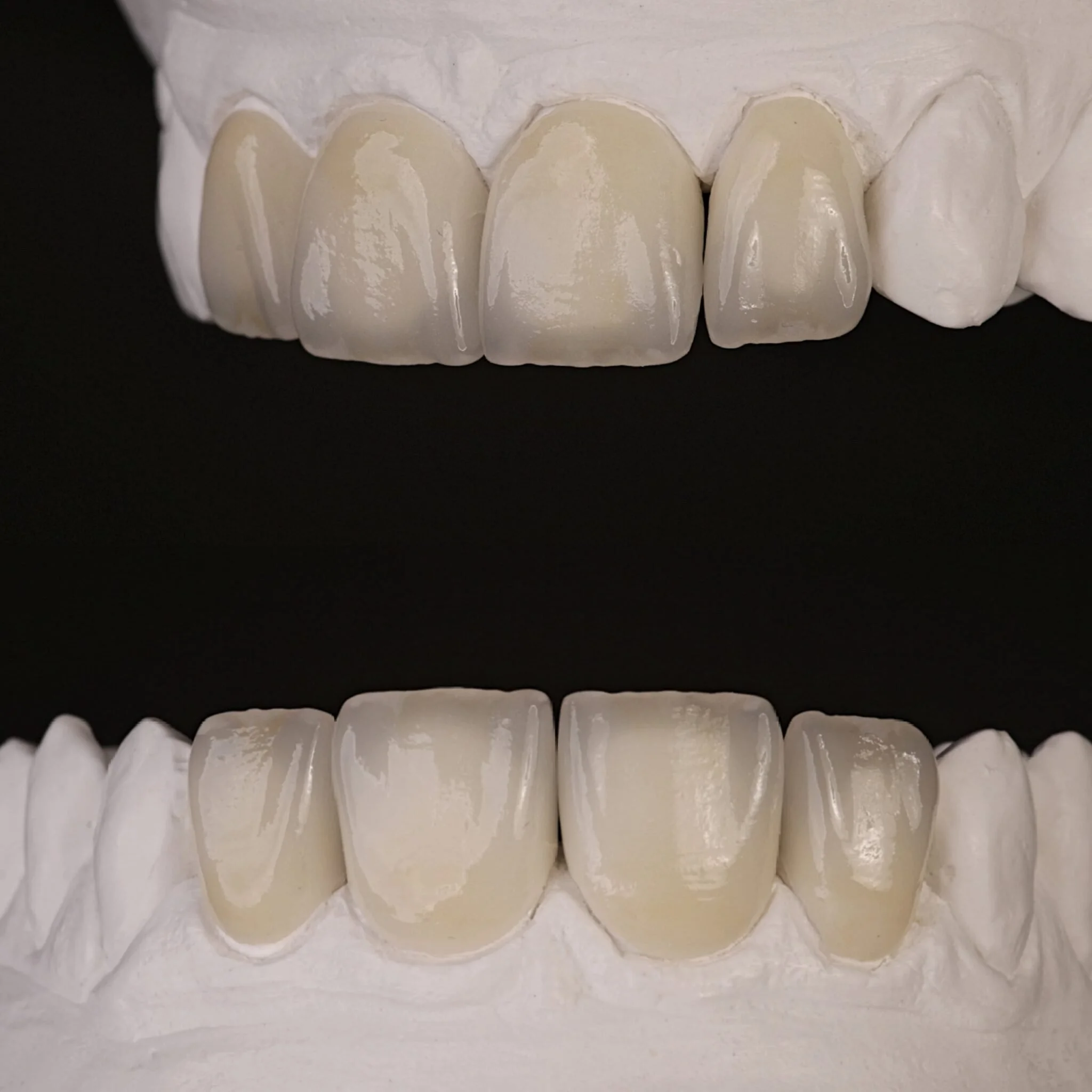 Close-up of a dental model showing upper and lower teeth on a white surface.