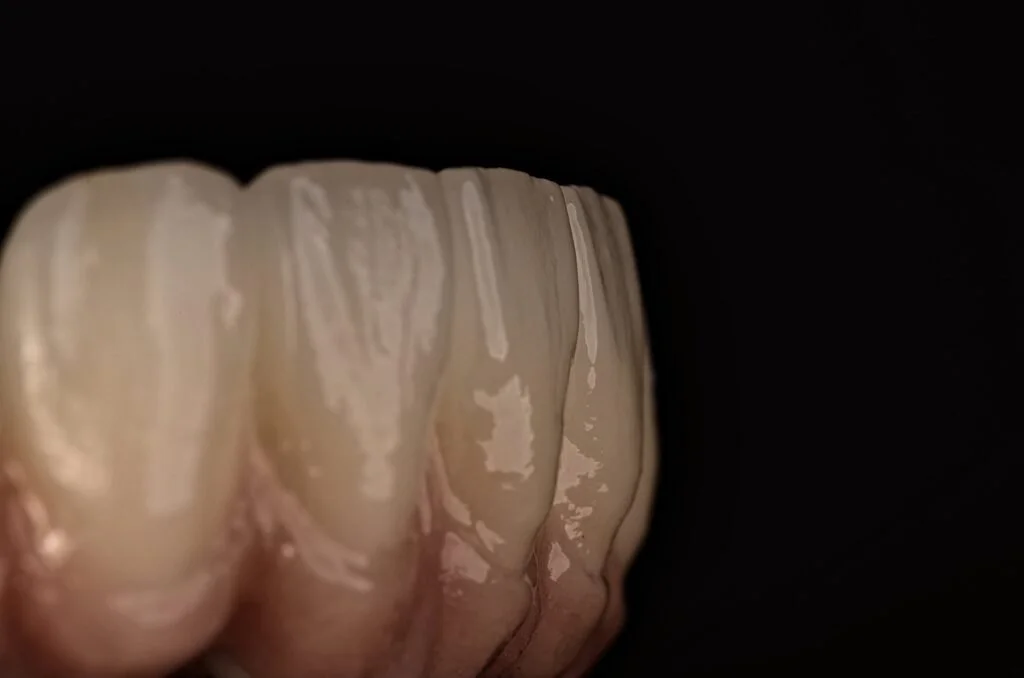 Close-up of human teeth against a black background.
