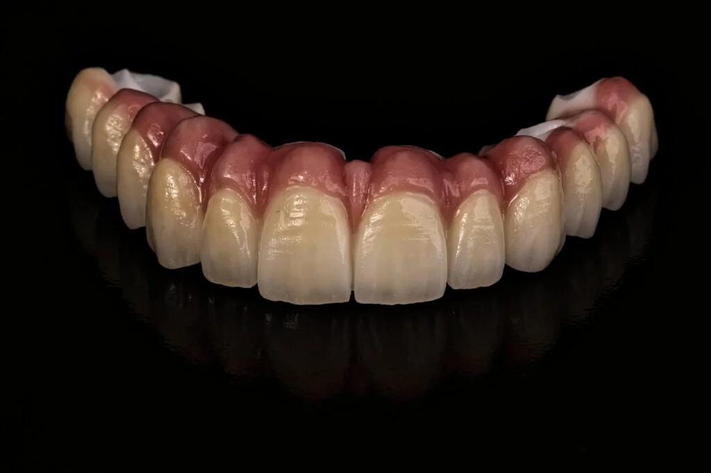 A set of artificial upper teeth and gums, resembling dentures, displayed against a black background.