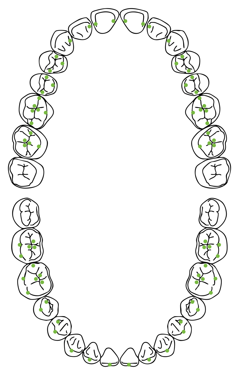 Illustration of a dental arch with teeth, highlighting the roots with green dots indicating nerve or blood vessel locations.