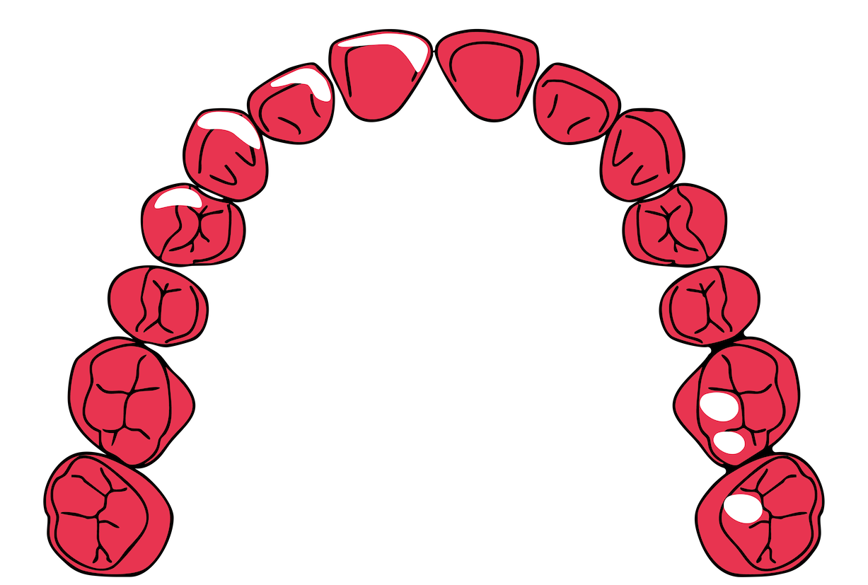 An illustration of the human teeth in a curved arch, showing the upper or lower dental set against a black background.