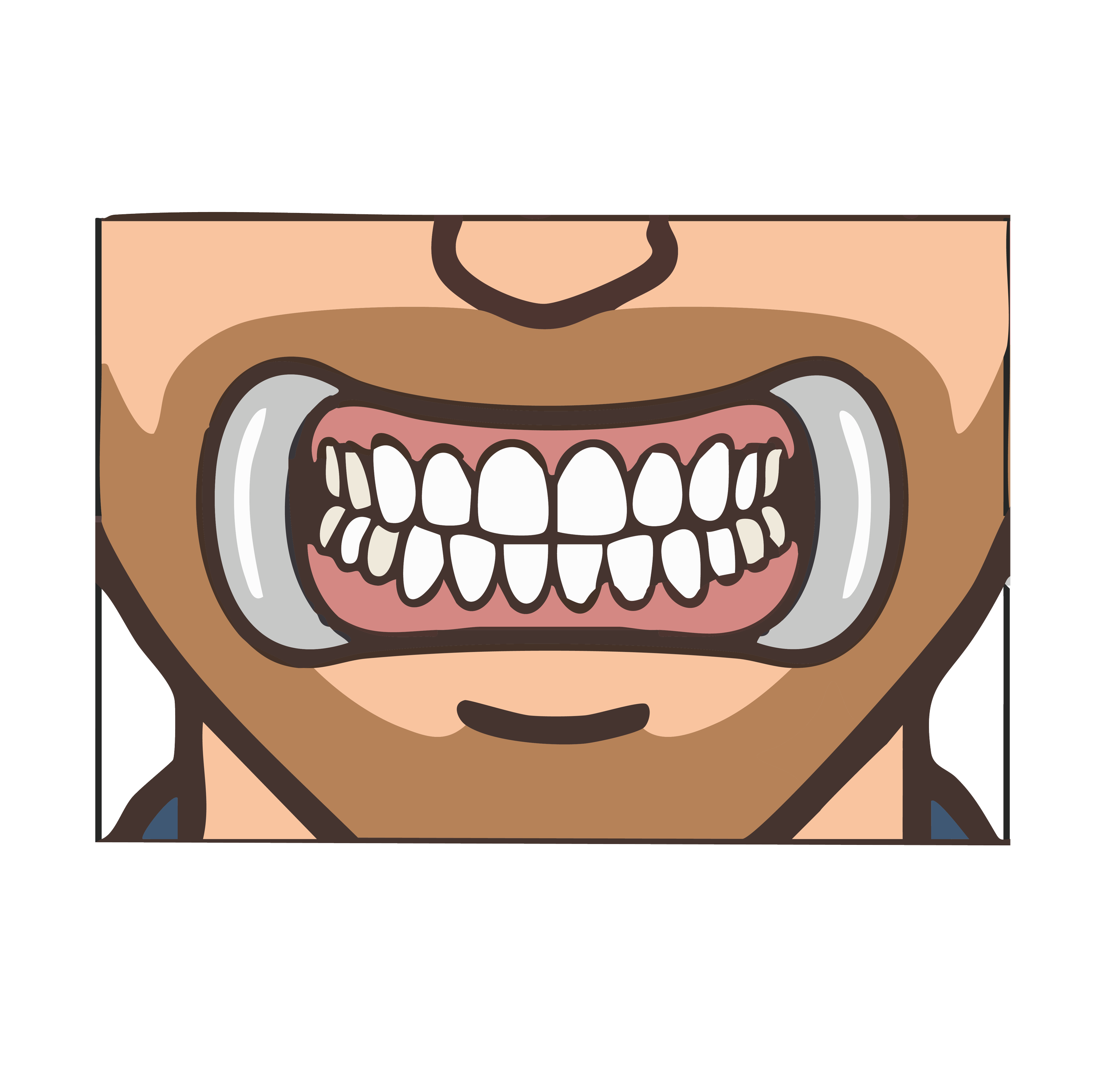 Close-up of a wide smile revealing all upper and lower teeth with a dark background.