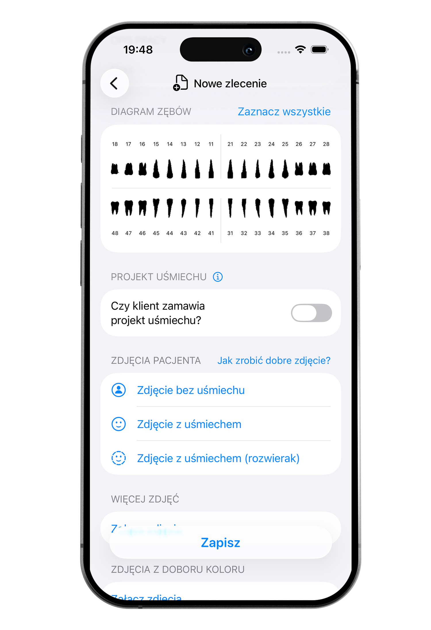 A smartphone screen displaying a medical app with socket diagram and options for patient photos and smile projects, in Polish language.