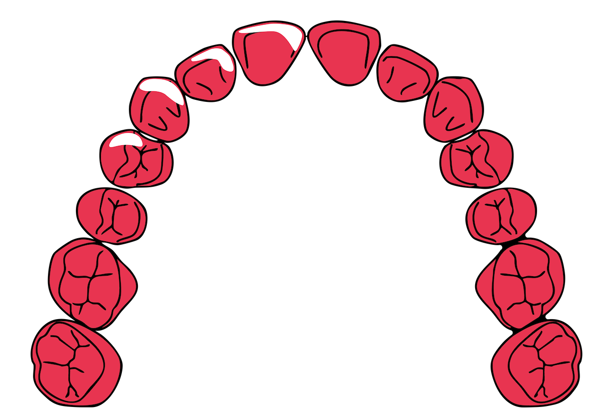 Illustration of a curved row of teeth, with some showing signs of decay or damage