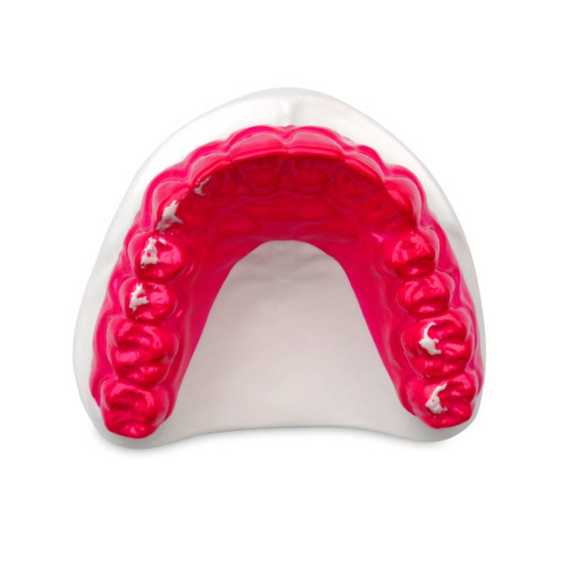A dental model of the upper jaw with false teeth in pink and white, mounted on a transparent base.