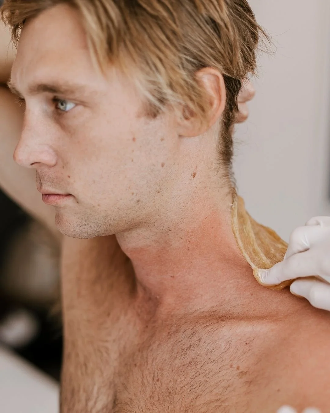 Close-up of a man with light skin and reddish hair getting a maple sugar scrub applied to his neck by a person wearing white gloves.