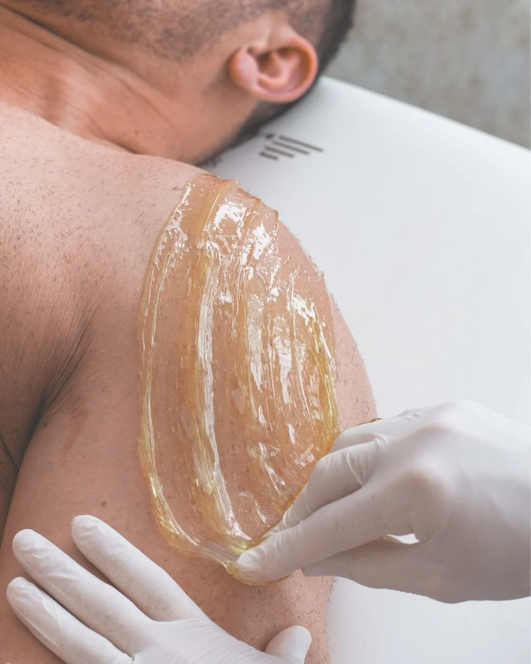 A person receiving a wax strip on their upper arm during a waxing procedure, with a technician wearing gloves.