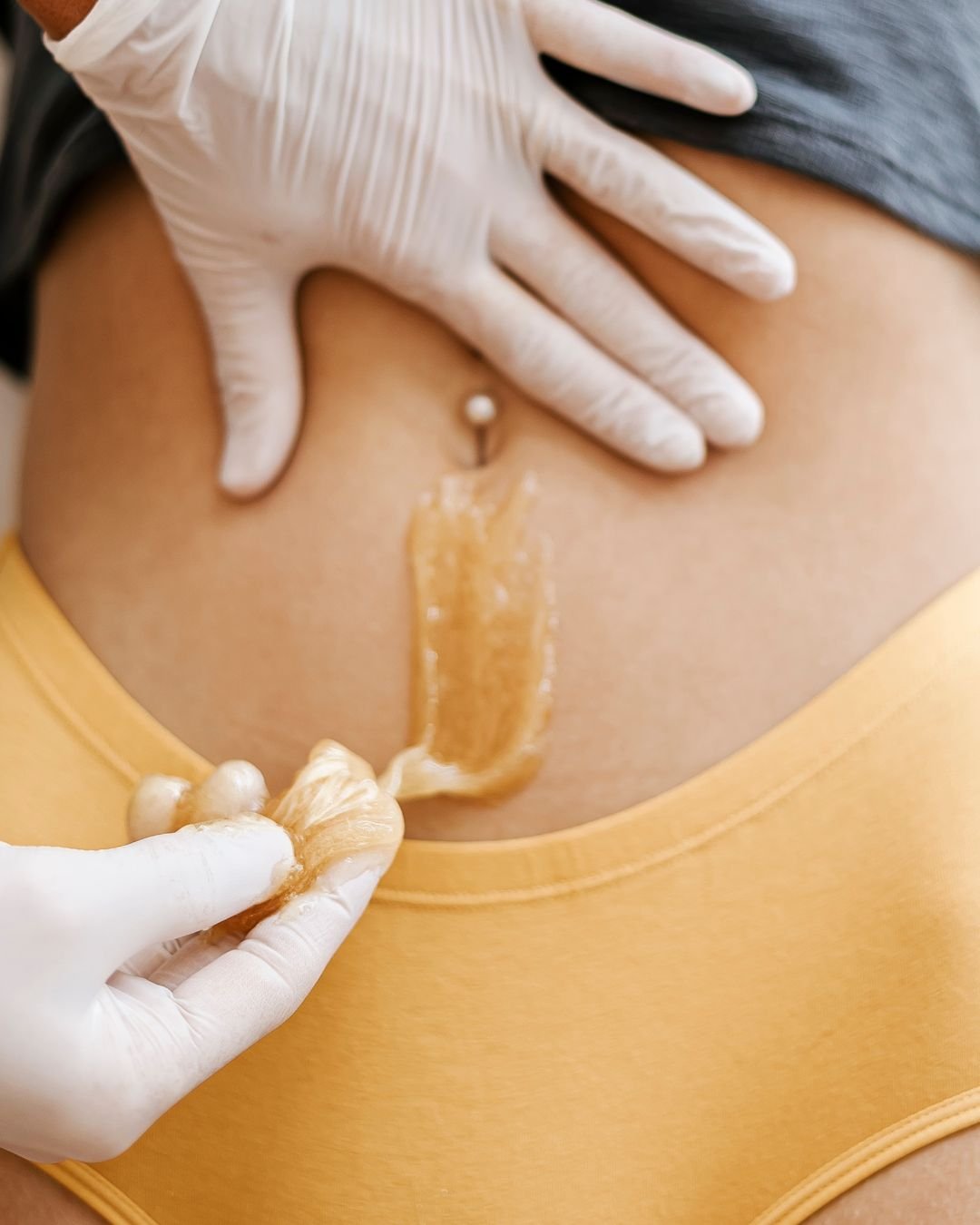 A person receiving a belly waxing treatment, with a gloved hand applying wax to the abdomen, and a metal or plastic spatula spreading wax, while another gloved hand holds the person's waistband.