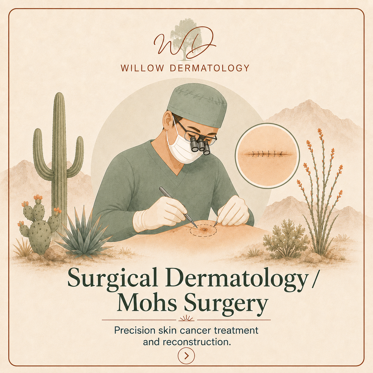 Illustration of a surgeon performing surgical dermatology or Mohs surgery to treat skin cancer, with desert plants in the background and a close-up of the incision site.
