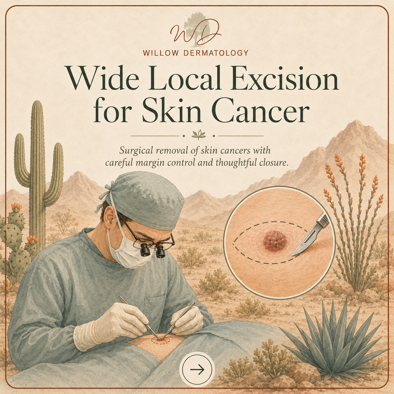 Illustration of a doctor performing skin cancer excision, with desert plants and mountains in the background, and an inset showing a close-up of the skin with a mole and excision tool.