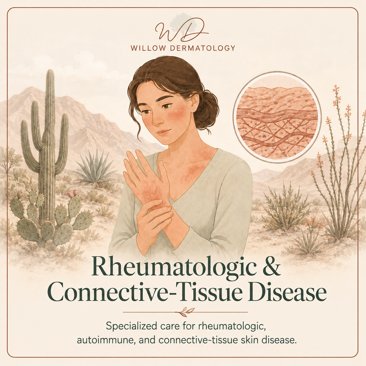 Illustration of a woman with skin affected by rheumatologic and connective-tissue disease, set against a desert landscape with cacti and mountains. An inset shows a close-up of skin with inflammation and connective tissue damage. The image promotes specialized care for rheumatologic, autoimmune, and connective-tissue skin diseases.