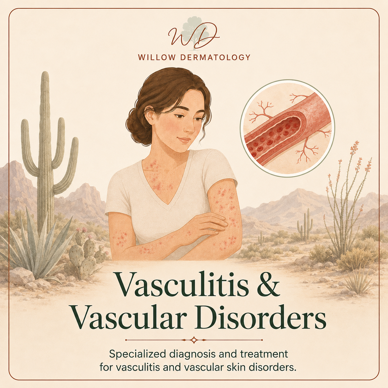 Illustration of a woman with skin inflammation, with an inset showing a close-up of a blood vessel affected by vasculitis, set against a desert landscape background with cacti and mountains, promoting diagnosis and treatment of vasculitis and vascular skin disorders.
