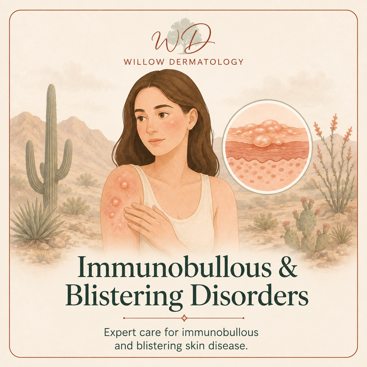 Illustration of a woman with skin blisters on her shoulder, set in a desert landscape with cacti and mountains. The image includes a close-up of skin blisters and clothing labels for Willow Dermatology addressing immunobullous and blistering skin disorders.